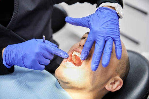 Best Emergency Dental Extractions in Fort Hall, ID